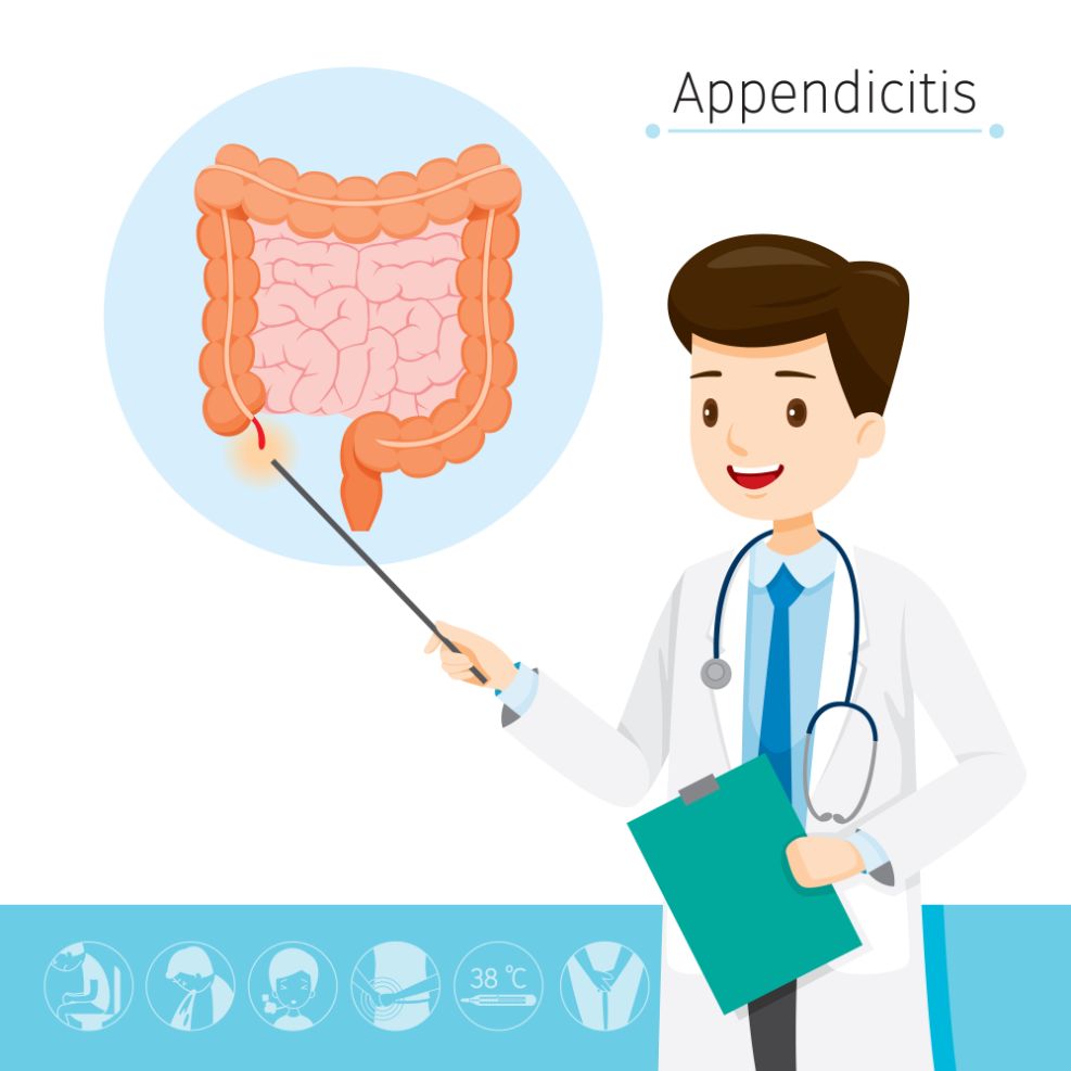Appendix Removal
