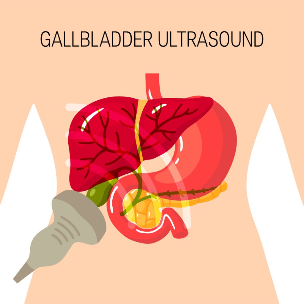 Gallbladder Removal