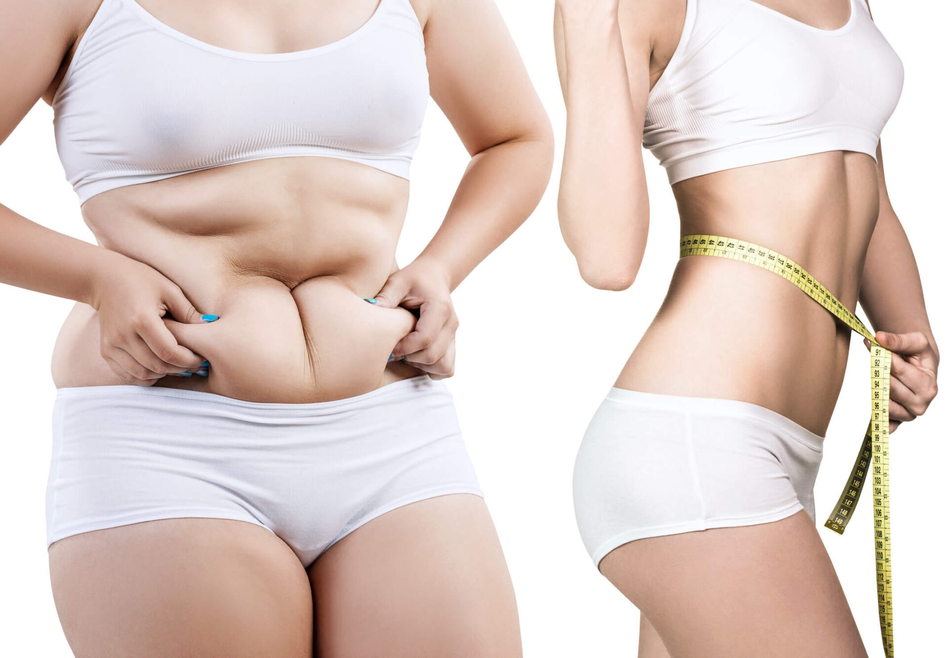 tummy tuck recovery